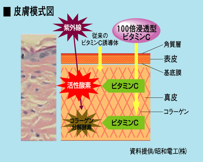 浸透模式図